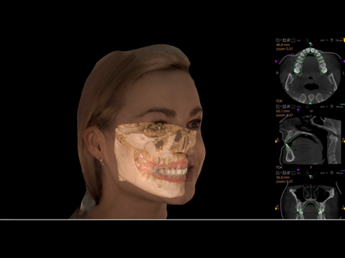 Face Scan